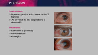 PTERÍGION
Cuadro clínico:
੦ hiperemia, prurito, ardor, sensaciónde CE,
lagrimeo
੦ ↓
AV en virtud del ↑
del astigmatismo o
obstrucción
Tratamiento:
੦ lubricantes e (paliativo)
੦ vasoconstrictor
੦ Quirúrgico
 