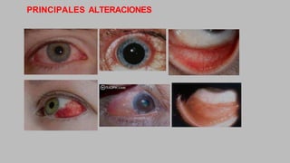 PRINCIPALES ALTERACIONES
 