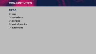 CONJUNTIVITES
TIPOS:
੦ viral
੦ bacteriana
੦ alérgica
੦ tóxica/química
੦ autoimune
 