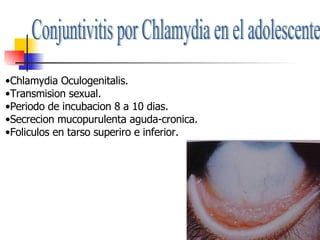 Conjuntivitis por Chlamydia en el adolescente Chlamydia Oculogenitalis. Transmision sexual. Periodo de incubacion 8 a 10 dias. Secrecion mucopurulenta aguda-cronica. Foliculos en tarso superiro e inferior. 