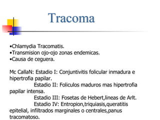 Tracoma Chlamydia Tracomatis. Transmision ojo-ojo zonas endemicas. Causa de ceguera. Mc CallaN: Estadio I: Conjuntivitis folicular inmadura e hipertrofia papilar. Estadio II: Foliculos maduros mas hipertrofia papilar intensa. Estadio III: Fosetas de Hebert,lineas de Arlt. Estadio IV: Entropion,triquiasis,queratitis epitelial, infiltrados marginales o centrales,panus tracomatoso. 