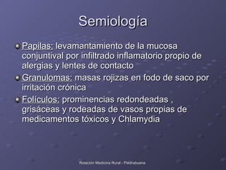 Semiología <ul><li>Papilas:  levamantamiento de la mucosa conjuntival por infiltrado inflamatorio propio de alergias y len...