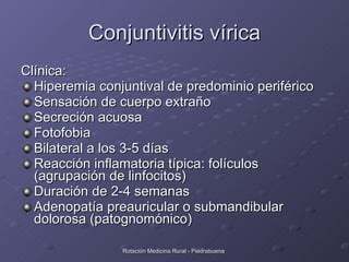 Conjuntivitis vírica <ul><li>Clínica: </li></ul><ul><li>Hiperemia conjuntival de predominio periférico </li></ul><ul><li>S...