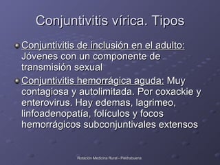 Conjuntivitis vírica. Tipos <ul><li>Conjuntivitis de inclusión en el adulto:  Jóvenes con un componente de transmisión sex...
