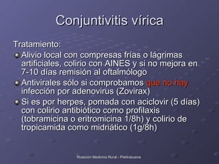 Conjuntivitis vírica <ul><li>Tratamiento: </li></ul><ul><li>Alivio local con compresas frías o lágrimas artificiales, coli...