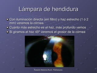 Lámpara de hendidura <ul><li>Con iluminación directa (sin filtro) y haz estrecho (1 ó 2 mm) veremos la córnea. </li></ul><...