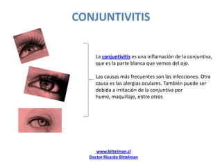 CONJUNTIVITIS La conjuntivitis es una inflamación de la conjuntiva,  que es la parte blanca que vemos del ojo.  Las causas más frecuentes son las infecciones. Otra causa es las alergias oculares. También puede ser debida a irritación de la conjuntiva por humo, maquillaje, entre otros www.bittelman.cl Doctor Ricardo Bittelman 