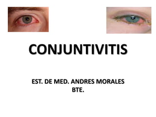 CONJUNTIVITIS
EST. DE MED. ANDRES MORALES
             BTE.
 