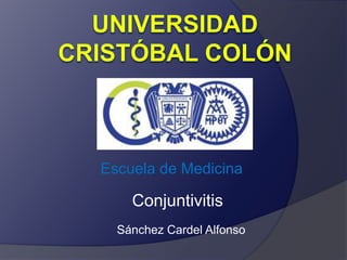 Escuela de Medicina 
Conjuntivitis 
Sánchez Cardel Alfonso 
 