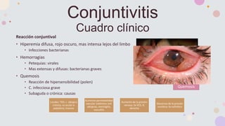 Reacción conjuntival
• Hiperemia difusa, rojo oscuro, mas intensa lejos del limbo
• Infecciones bacterianas
• Hemorragias
• Petequias: virales
• Mas extensas y difusas: bacterianas graves
• Quemosis
• Reacción de hipersensibilidad (polen)
• C. infecciosa grave
• Subaguda o crónica: causas
Conjuntivitis
Cuadro clínico
Locales: TED, c. alérgica
crónica, cx ocular o
palpebral, trauma
Aumento permeabilidad
vascular sistémica: enf.
alérgicas, meningitis,
vasculitis
Aumento de la presión
venosa: Sx VCS, IC
derecha
Descenso de la presión
oncótica: Sx nefrótico
Quemosis
 