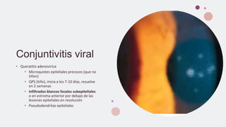Conjuntivitis viral
• Queratitis adenovirica
• Microquistes epiteliales precoces (que no
tiñen)
• QPS (tiñe), inicia a los 7-10 días, resuelve
en 2 semanas
• Infiltrados blancos focales subepiteliales
o en estroma anterior por debajo de las
lesiones epiteliales en resolución
• Pseudodendritas epiteliales
 