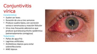 Conjuntivitis
vírica
Características
• Suelen ser leves
• Duración de una a tres semanas
• Produce cuadro típico, con secreción
serosa o seromucosa y reacción folicular
• Virus mas frecuente adenovirus que
produce queratoconjuntivitis epidérmica
(extremadamente contagiosa)
Tratamiento
• Paños de agua fría
• Lagrimas artificiales
• Antibióticos tópicos para evitar
sobreinfecciones
• AINE tópicos
 