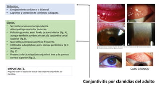 Síntomas.
• Enrojecimiento unilateral o bilateral
• Lagrimeo y secreción de comienzo subagudo.
IMPORTANTE.
Preguntar sobre la exposición sexual si se sospecha conjuntivitis por
clamidias.
Signos.
• Secreción acuosa o mucopurulenta.
• Adenopatía preauricular dolorosa.
• Folículos grandes, en el fondo de saco inferior (fig. A),
aunque también pueden afectar a la conjuntiva tarsal
superior (fig.B).
• Queratitis punteada superficial frecuente.
• Infiltrados subepiteliales en la córnea perilímbica (2-3
semanas)
• (fig. C)
• Presencia de cicatrización conjuntival leve y de pannus
corneal superior (fig.D).
CASO CRONICO
Conjuntivitis por clamidias del adulto
 