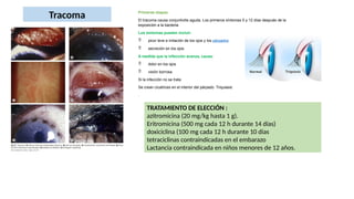 Primeras etapas
El tracoma causa conjuntivitis aguda. Los primeros síntomas 5 y 12 días después de la
exposición a la bacteria.
Los síntomas pueden incluir:
 picor leve e irritación de los ojos y los párpados
 secreción en los ojos
A medida que la infección avanza, causa:
 dolor en los ojos
 visión borrosa.
Si la infección no se trata
Se crean cicatrices en el interior del párpado. Triquiasis
.
Tracoma
TRATAMIENTO DE ELECCIÓN :
azitromicina (20 mg/kg hasta 1 g).
Eritromicina (500 mg cada 12 h durante 14 días)
doxiciclina (100 mg cada 12 h durante 10 días
tetraciclinas contraindicadas en el embarazo
Lactancia contraindicada en niños menores de 12 años.
 