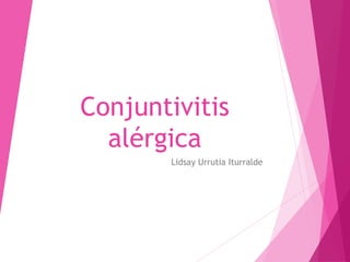 Conjuntivitis 
alérgica 
Lidsay Urrutia Iturralde 
 