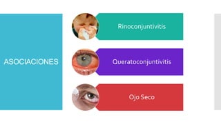 ASOCIACIONES
Rinoconjuntivitis
Queratoconjuntivitis
Ojo Seco
 