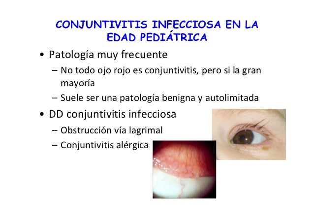 Eritema toxico recien nacido pdf creator
