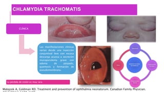 CONJUNTIVITIS NEONATAL | PPTX