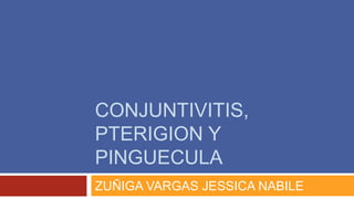 CONJUNTIVITIS,
PTERIGION Y
PINGUECULA
ZUÑIGA VARGAS JESSICA NABILE
 