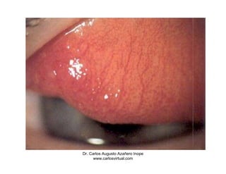 Dr. Carlos Augusto Azañero Inope
      www.carlosvirtual.com
 