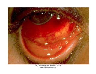 Dr. Carlos Augusto Azañero Inope
      www.carlosvirtual.com
 