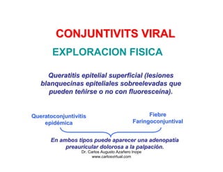 CONJUNTIVITS VIRAL
       EXPLORACION FISICA

     Queratitis epitelial superficial (lesiones
   blanquecinas epiteliales ...