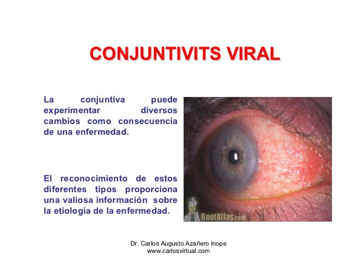 Gu a cl nica de Conjuntivitis bacterianas