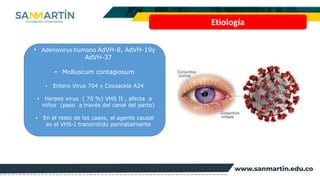Etiología
• Adenovirus humano AdVH-8, AdVH-19y
AdVH-37
• Molluscum contagiosum
• Entero Virus 704 y Coxsackie A24
• Herpes...