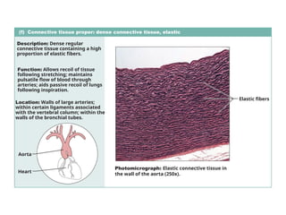 (f) Connective tissue proper: dense connective tissue, elastic
Description: Dense regular
connective tissue containing a high
proportion of elastic fibers.
Function: Allows recoil of tissue
following stretching; maintains
pulsatile flow of blood through
arteries; aids passive recoil of lungs
following inspiration.
Location: Walls of large arteries;
within certain ligaments associated
with the vertebral column; within the
walls of the bronchial tubes.
Elastic fibers
Aorta
Heart
Photomicrograph: Elastic connective tissue in
the wall of the aorta (250x).
 