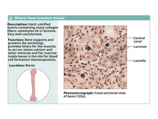 (j) Others: bone (osseous tissue)
Description: Hard, calcified
matrix containing many collagen
fibers; osteocytes lie in lacunae.
Very well vascularized.
Function: Bone supports and
protects (by enclosing);
provides levers for the muscles
to act on; stores calcium and
other minerals and fat; marrow
inside bones is the site for blood
cell formation (hematopoiesis).
Location: Bones
Photomicrograph: Cross-sectional view
of bone (125x).
Lacunae
Lamella
Central
canal
 
