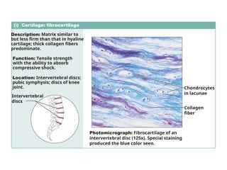 (i) Cartilage: fibrocartilage
Description: Matrix similar to
but less firm than that in hyaline
cartilage; thick collagen fibers
predominate.
Function: Tensile strength
with the ability to absorb
compressive shock.
Location: Intervertebral discs;
pubic symphysis; discs of knee
joint.
Photomicrograph: Fibrocartilage of an
intervertebral disc (125x). Special staining
produced the blue color seen.
Intervertebral
discs
Chondrocytes
in lacunae
Collagen
fiber
 