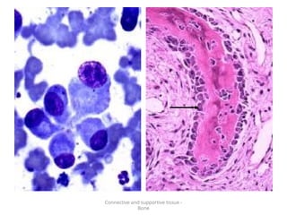 Connective and supportive tissue -
Bone
 