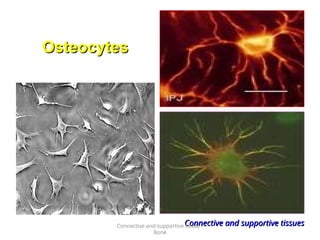 Connective and supportive tissues
Connective and supportive tissues
Osteocytes
Osteocytes
Connective and supportive tissue -
Bone
 