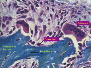 Osteoclast
Osteoblast
Osteocyte in
Lacuna
Bone Matrix
Connective and supportive tissue -
Bone
 