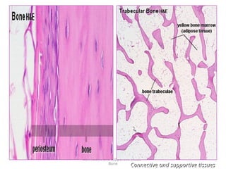 Connective and supportive tissue -
Bone
Connective and supportive tissues
Connective and supportive tissues
 