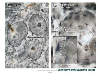 Connective and supportive tissue -
Bone
Connective and supportive tissues
Connective and supportive tissues
 