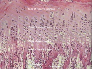 Connective and supportive tissue -
Bone
Zone of reserve cartilage
Zone of multiplication
Zone of hypertrophy
Zone of calcification
Osteocytes
Osteoblast
 