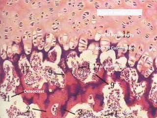 Connective and supportive tissue -
Bone
Zone of multiplication
Zone of hypertrophy
Zone of Calcification
Zone of ossification
Osteoclast
 