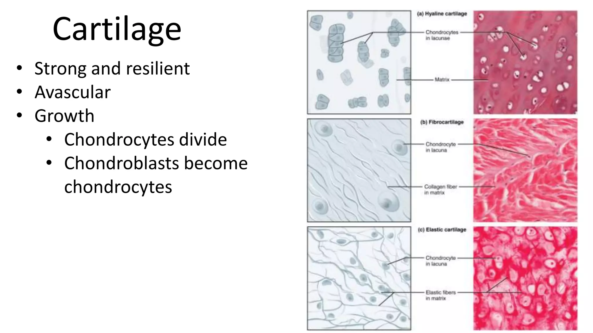 Cartilage
• Strong and resilient
• Avascular
• Growth
• Chondrocytes divide
• Chondroblasts become
chondrocytes