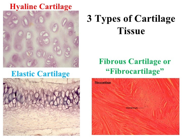 Connective tissue