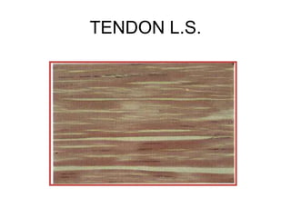 TENDON L.S.
 