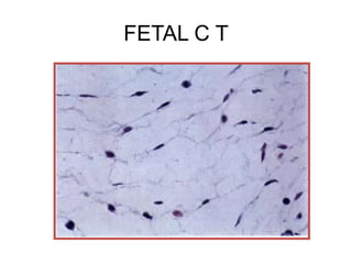 FETAL C T
 