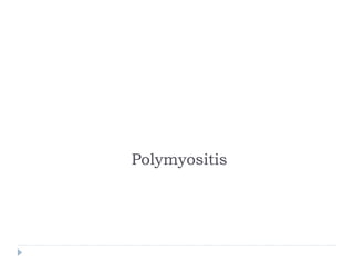 Polymyositis
 