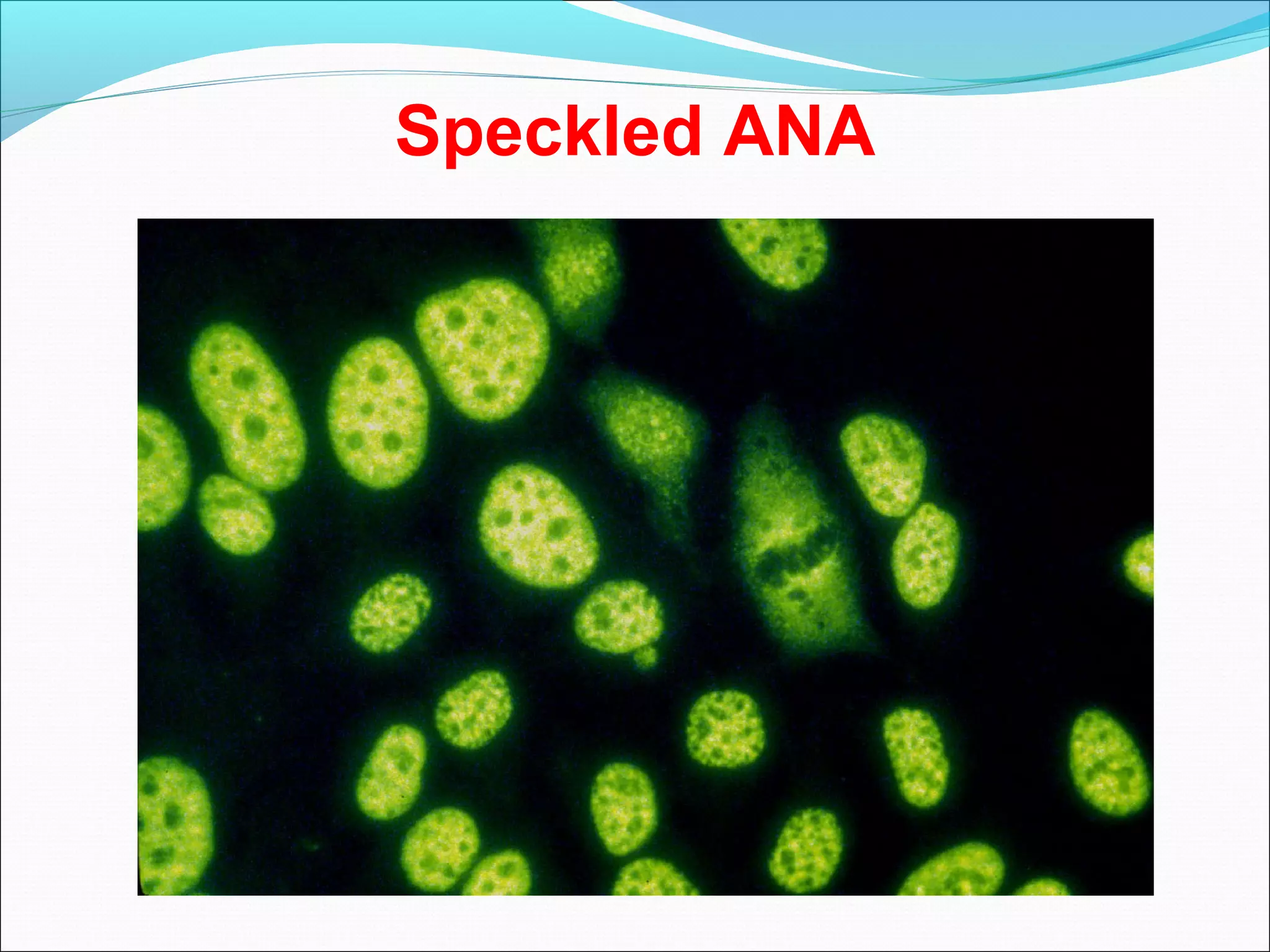 Speckled ANA
 