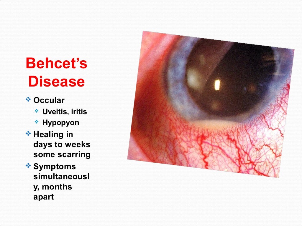 Connective tissue diseases (7)
