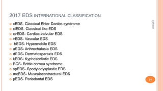 2017 EDS INTERNATIONAL CLASSIFICATION
 cEDS- Classical Ehler-Danlos syndrome
 clEDS- Classical-like EDS
 cvEDS- Cardiac-valvular EDS
 vEDS- Vascular EDS
 hEDS- Hypermobile EDS
 aEDS- Arthrochalasia EDS
 dEDS- Dermatosparaxis EDS
 kEDS- Kyphoscoliotic EDS
 BCS- Brittle cornea syndrome
 spEDS- Spodylodysplastic EDS
 mcEDS- Musculocontractural EDS
 pEDS- Periodontal EDS
3/31/2021
24
 