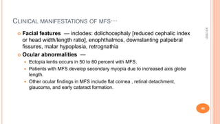 CLINICAL MANIFESTATIONS OF MFS···
 Facial features — inclodes: dolichocephaly [reduced cephalic index
or head width/length ratio], enophthalmos, downslanting palpebral
fissures, malar hypoplasia, retrognathia
 Ocular abnormalities —
 Ectopia lentis occurs in 50 to 80 percent with MFS.
 Patients with MFS develop secondary myopia due to increased axis globe
length.
 Other ocular findings in MFS include flat cornea , retinal detachment,
glaucoma, and early cataract formation.
3/31/2021
46
 