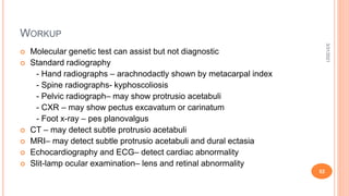 WORKUP
 Molecular genetic test can assist but not diagnostic
 Standard radiography
- Hand radiographs – arachnodactly shown by metacarpal index
- Spine radiographs- kyphoscoliosis
- Pelvic radiograph– may show protrusio acetabuli
- CXR – may show pectus excavatum or carinatum
- Foot x-ray – pes planovalgus
 CT – may detect subtle protrusio acetabuli
 MRI– may detect subtle protrusio acetabuli and dural ectasia
 Echocardiography and ECG– detect cardiac abnormality
 Slit-lamp ocular examination– lens and retinal abnormality
3/31/2021
52
 