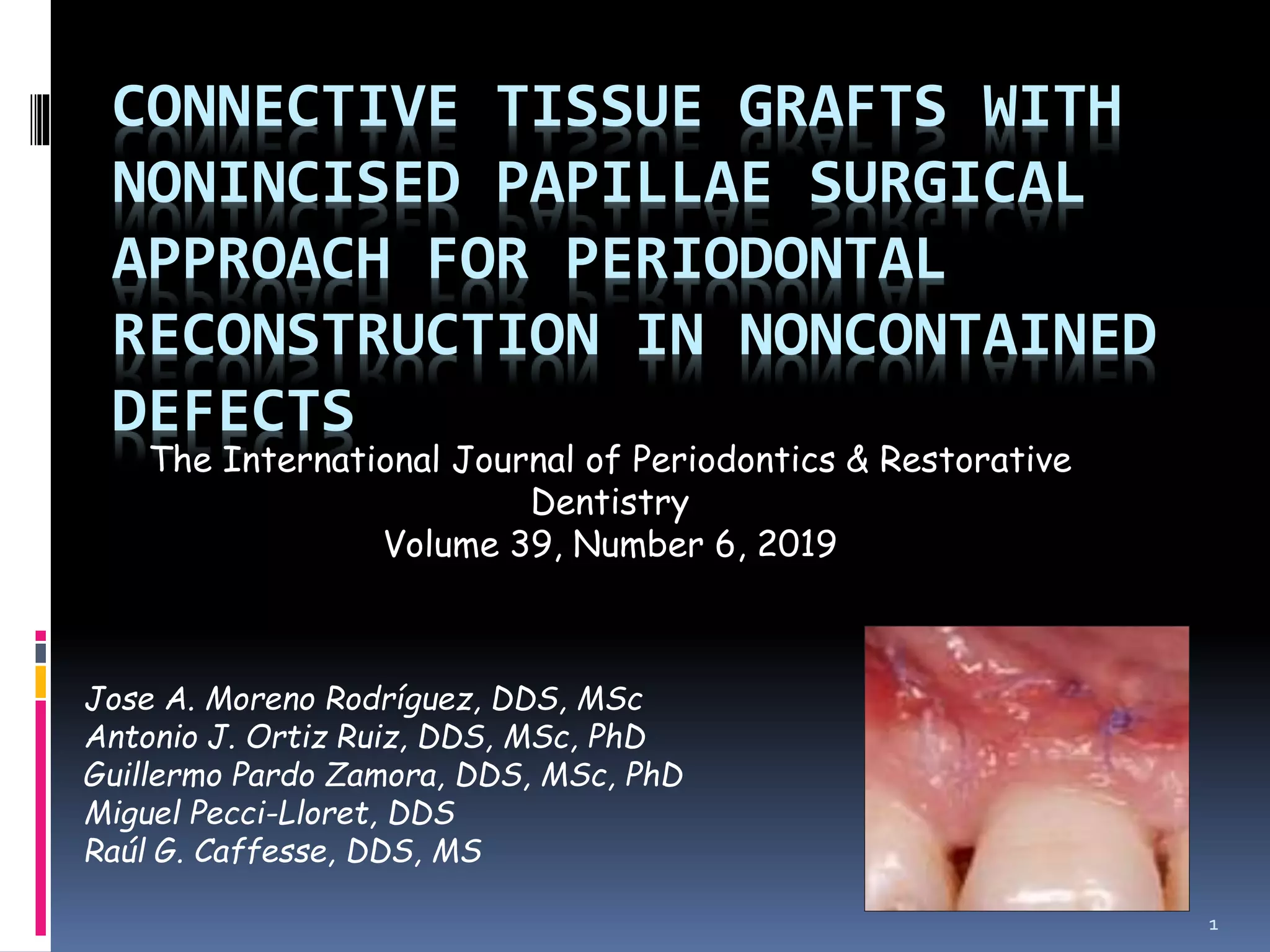 Connective tissue grafts PPT