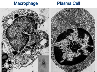 Macrophage Plasma Cell
 